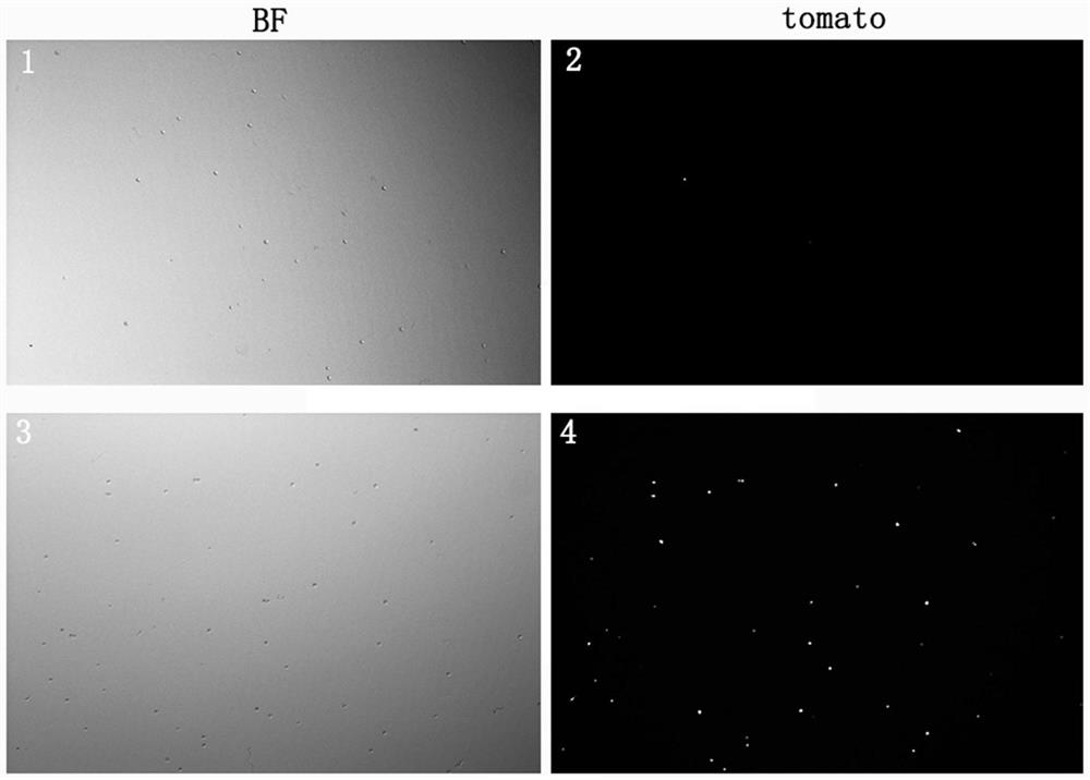 Method for separating inner ear FZD10 positive glial cells