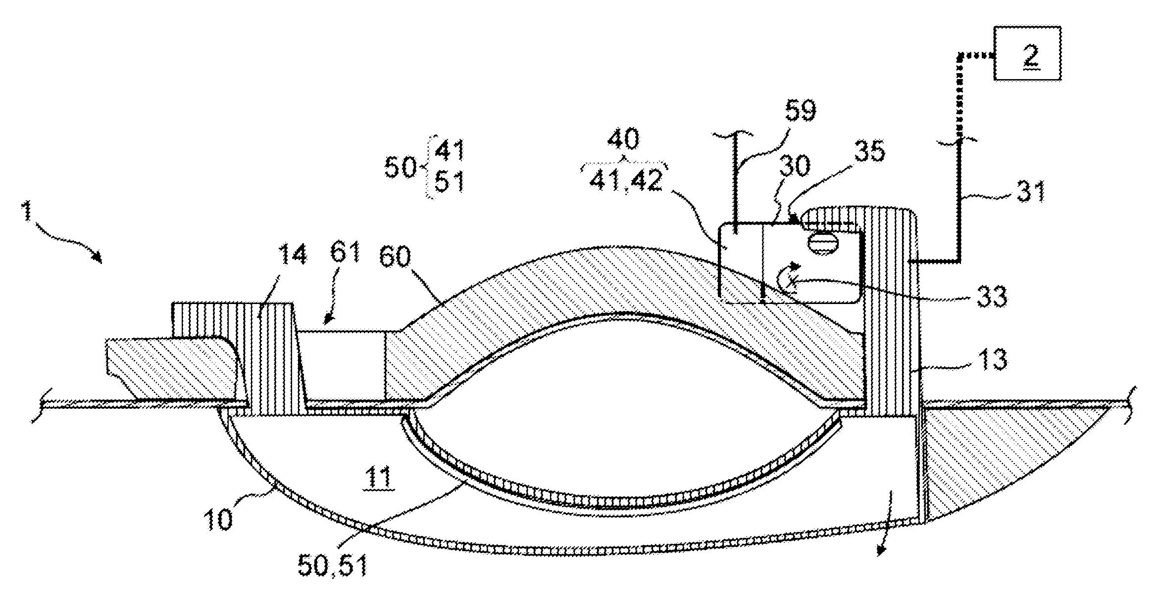 Operating device with electronics, at least partially operating as a dynamic balancer