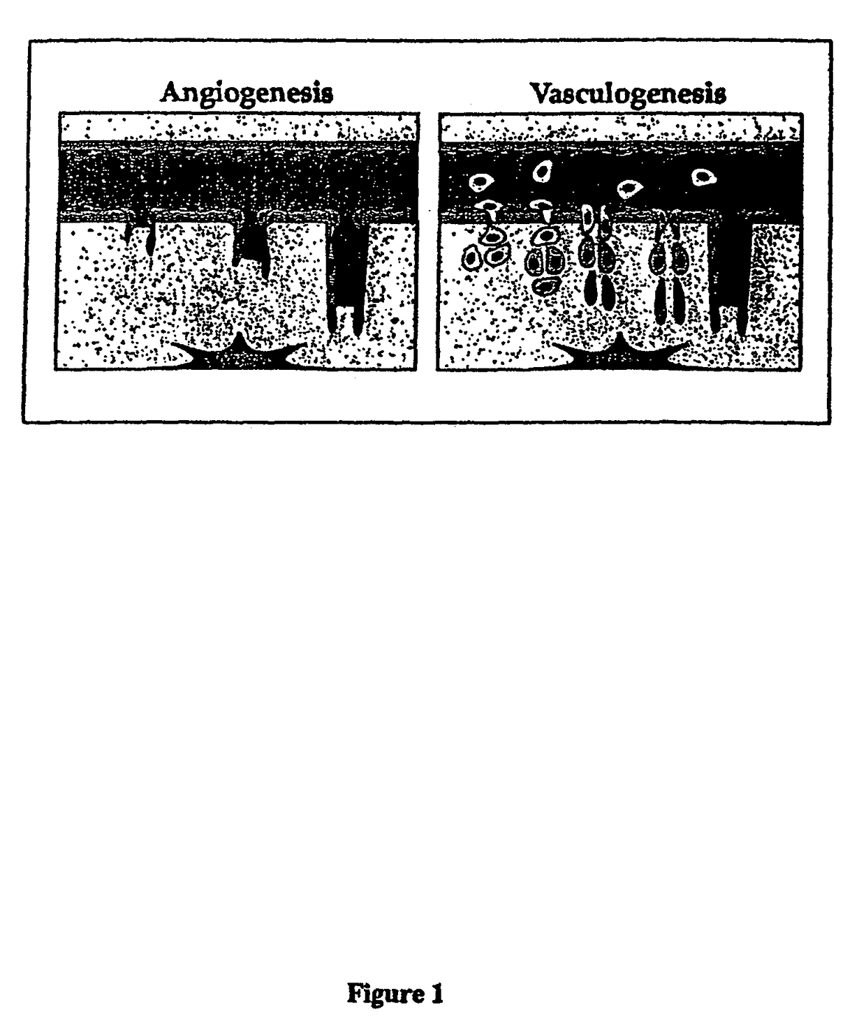 Method of treating or preventing pathologic effects of acute increases in hyperglycemia and/or acute increases of free fatty acid flux