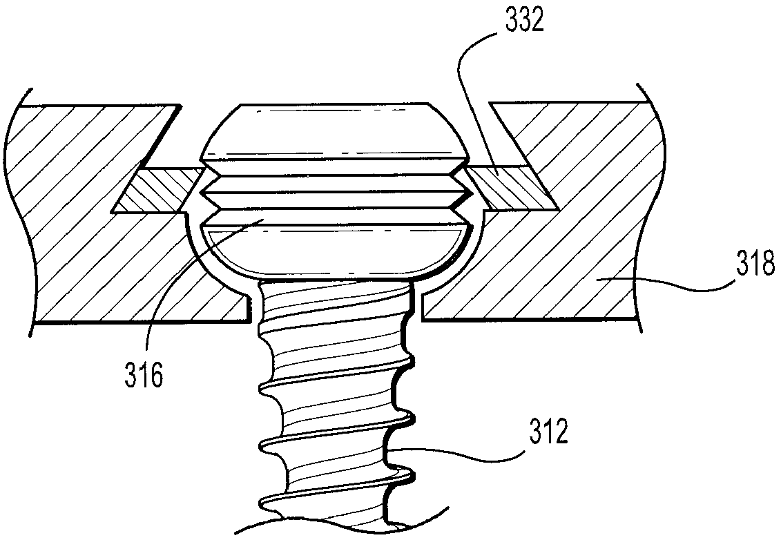 Fastener retention system