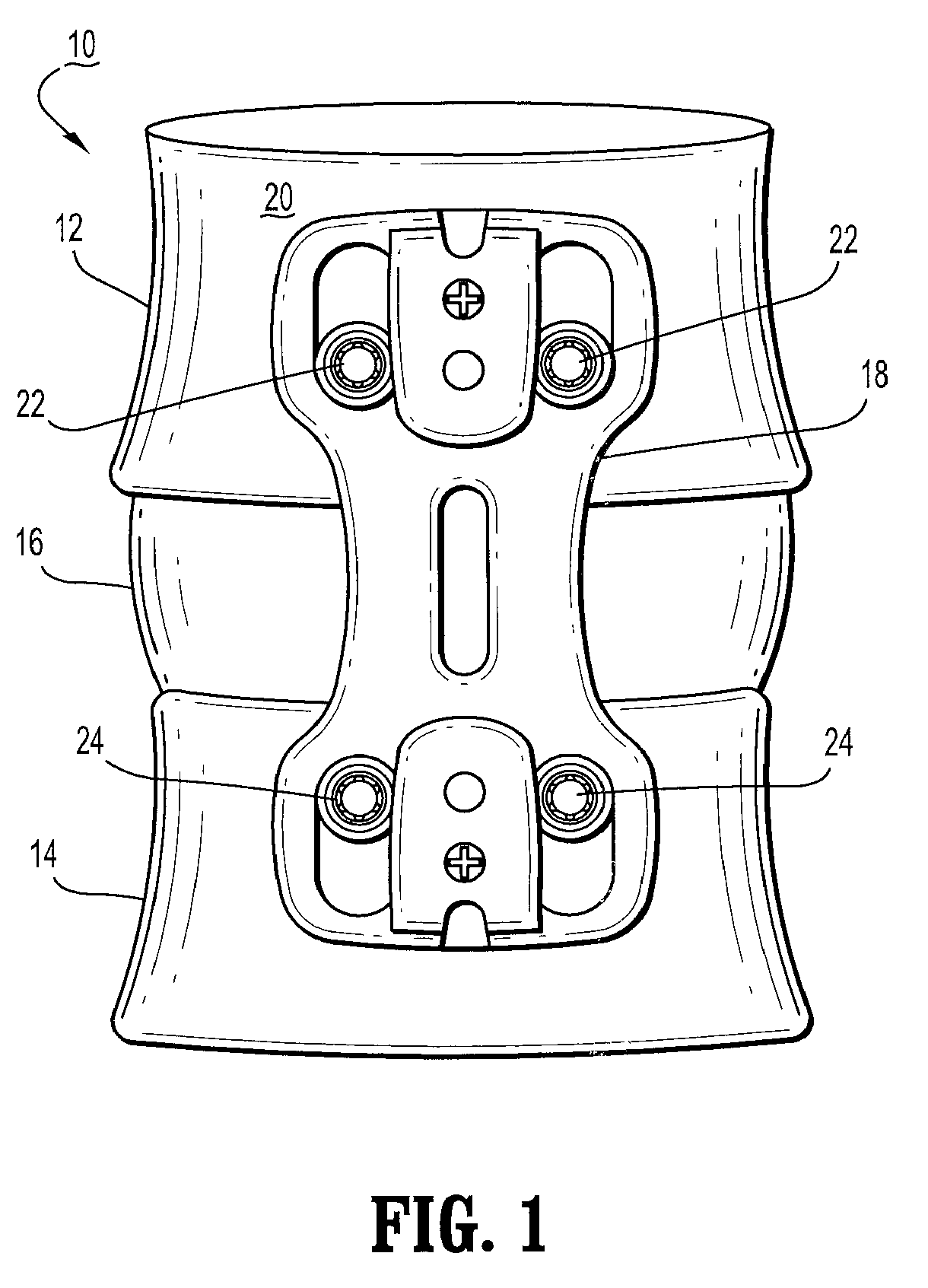 Fastener retention system