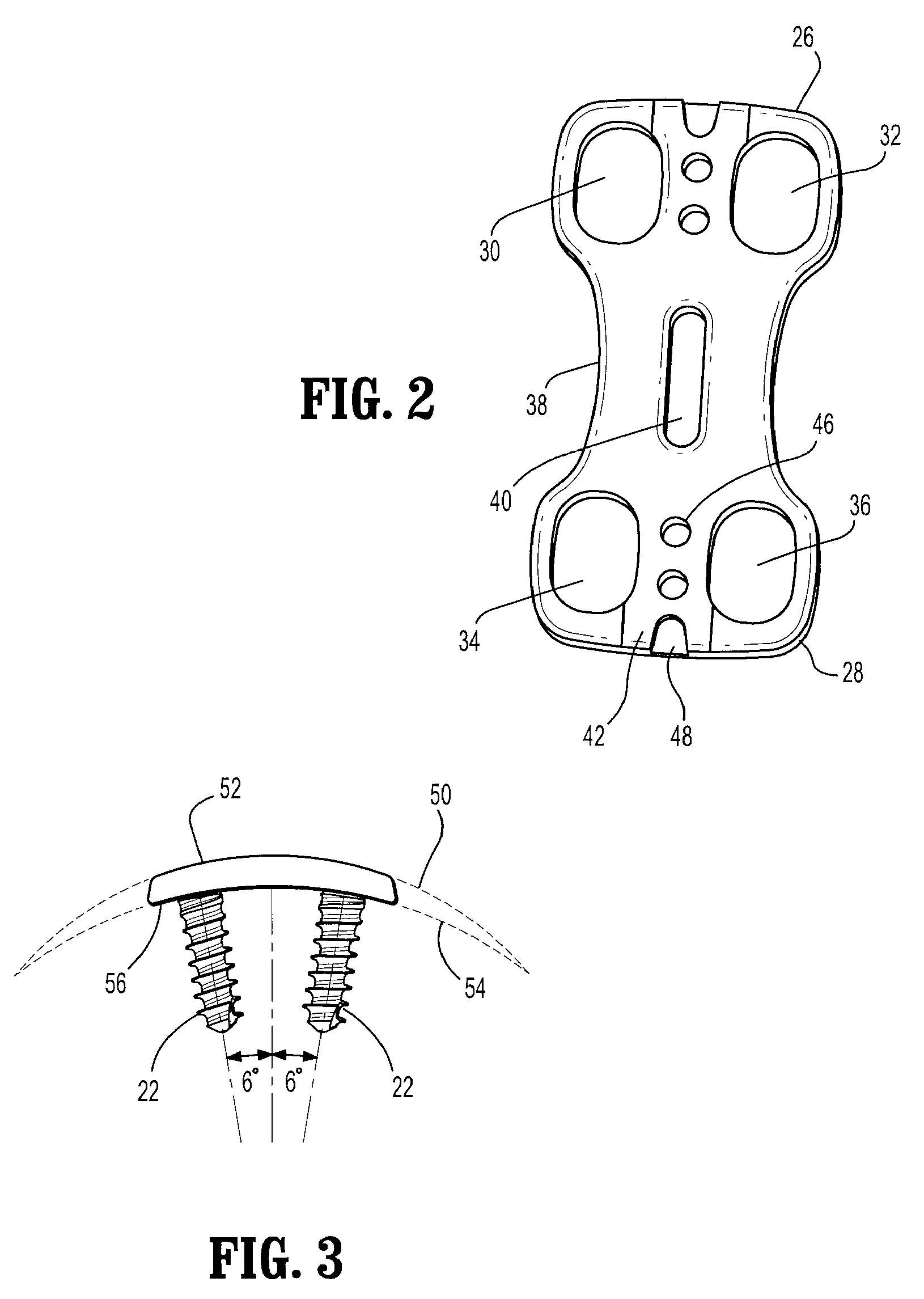 Fastener retention system