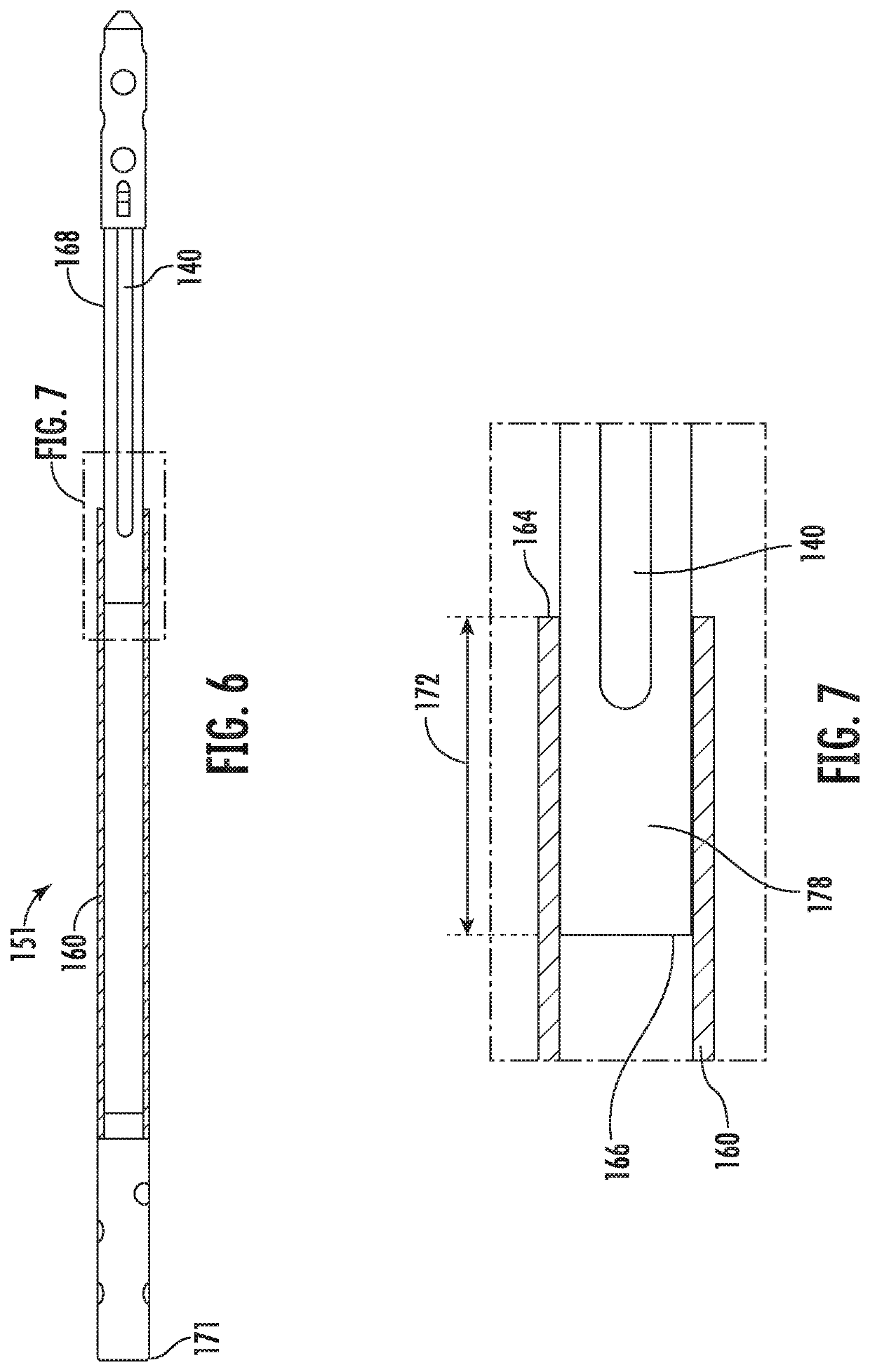 Implantable bone adjustment devices