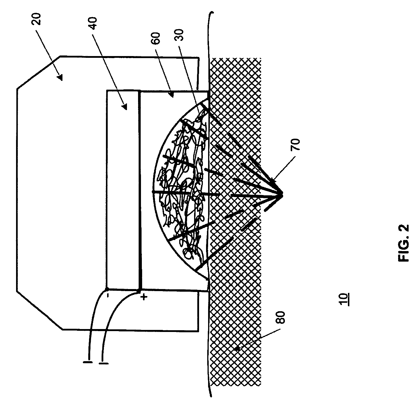 Ultrasound moxibustion method and device