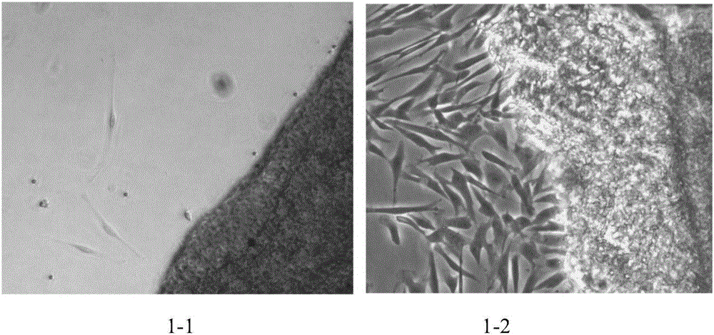 Placental villus plate mesenchymal stem cells and clinical preparation method