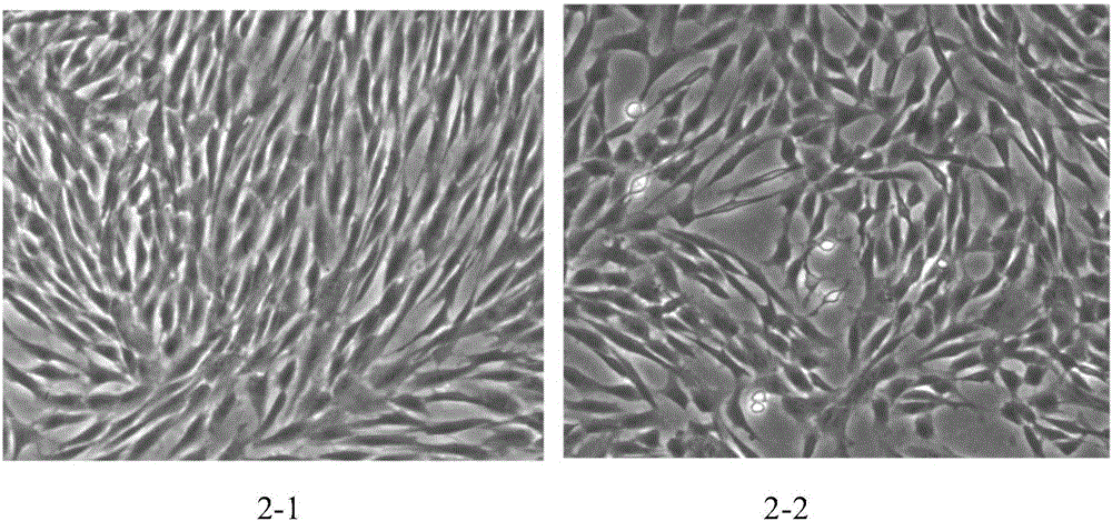 Placental villus plate mesenchymal stem cells and clinical preparation method