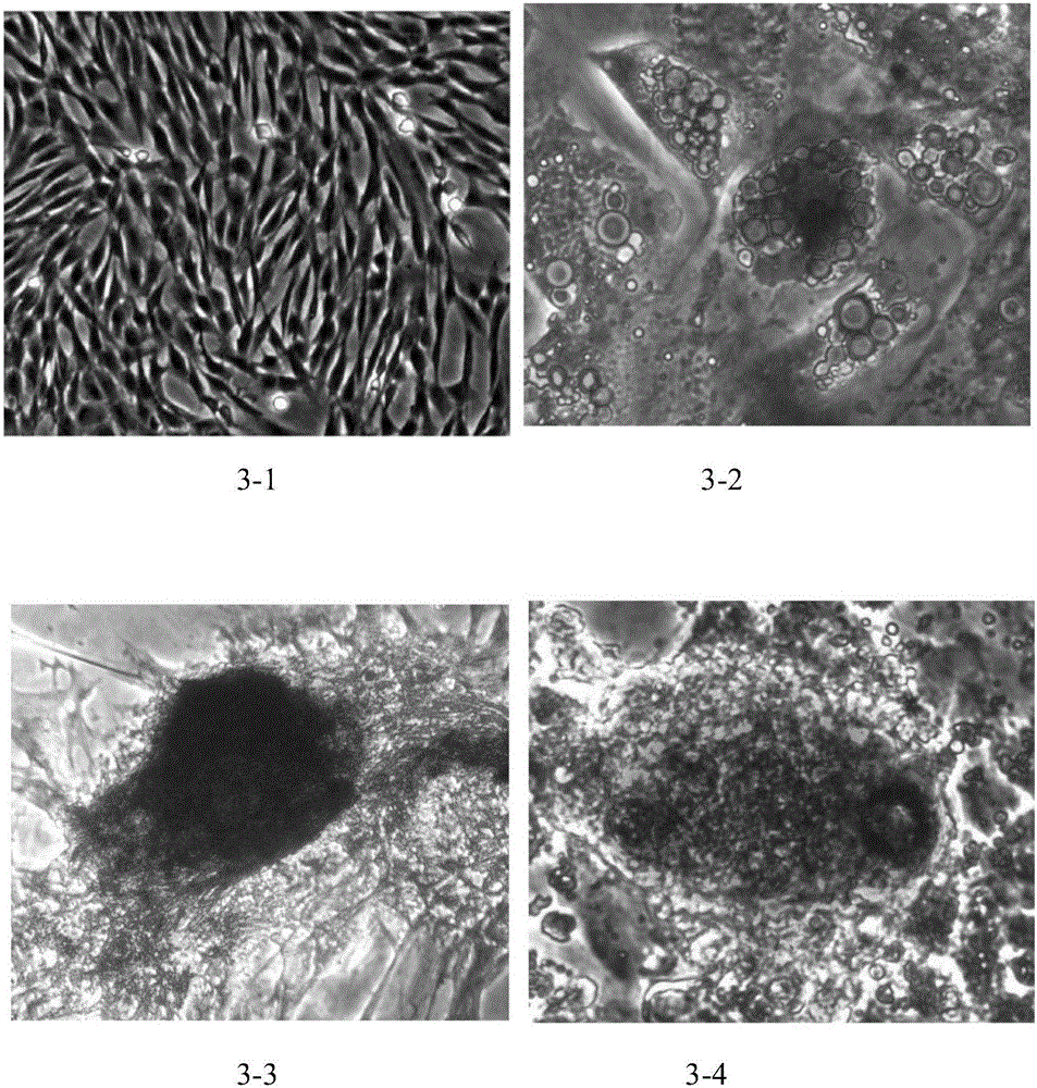 Placental villus plate mesenchymal stem cells and clinical preparation method