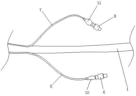 Adjustable-negative-pressure multifunctional excrement drainage device