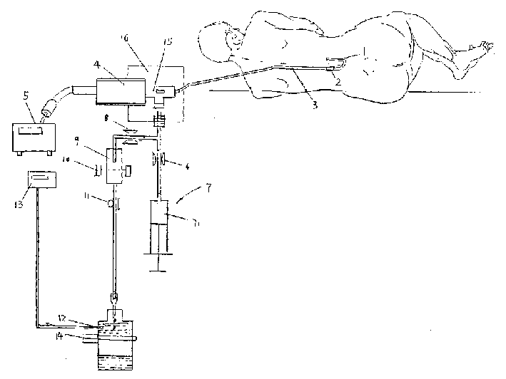 Monitoring and therapeutic apparatus for draining and displacing cerebrospinal fluid and pressurizing