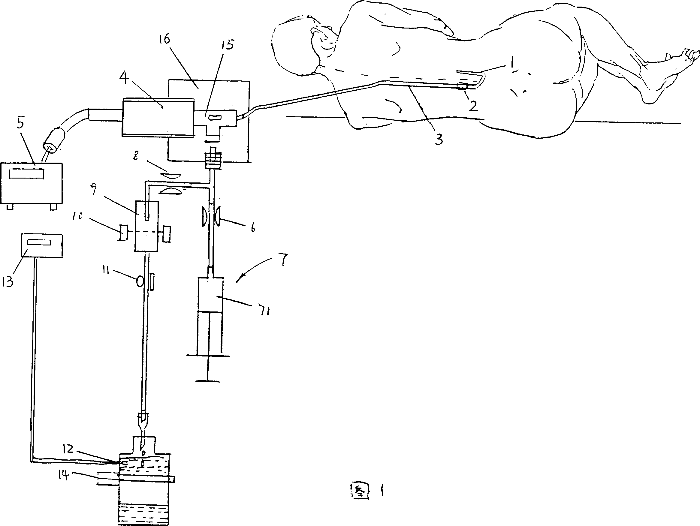 Monitoring and therapeutic apparatus for draining and displacing cerebrospinal fluid and pressurizing