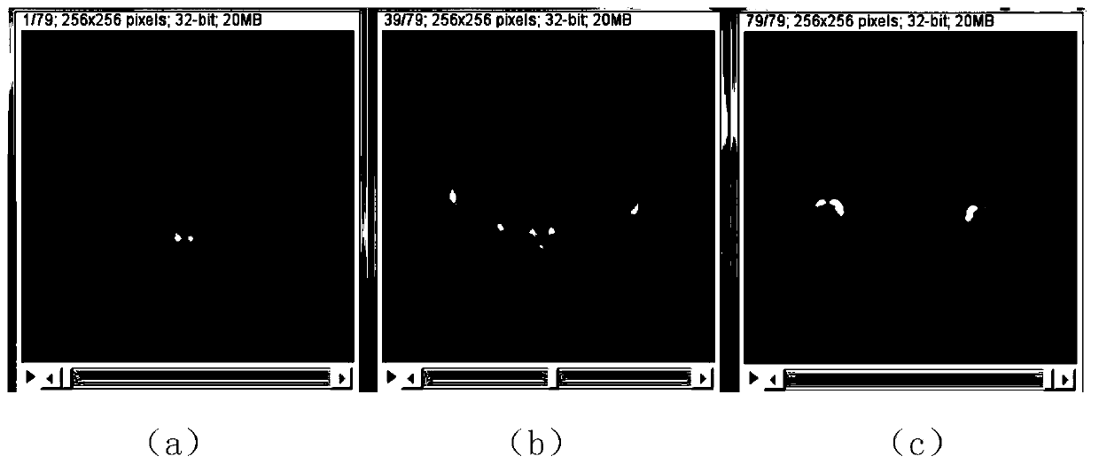 Bone fault image reconstruction method and system