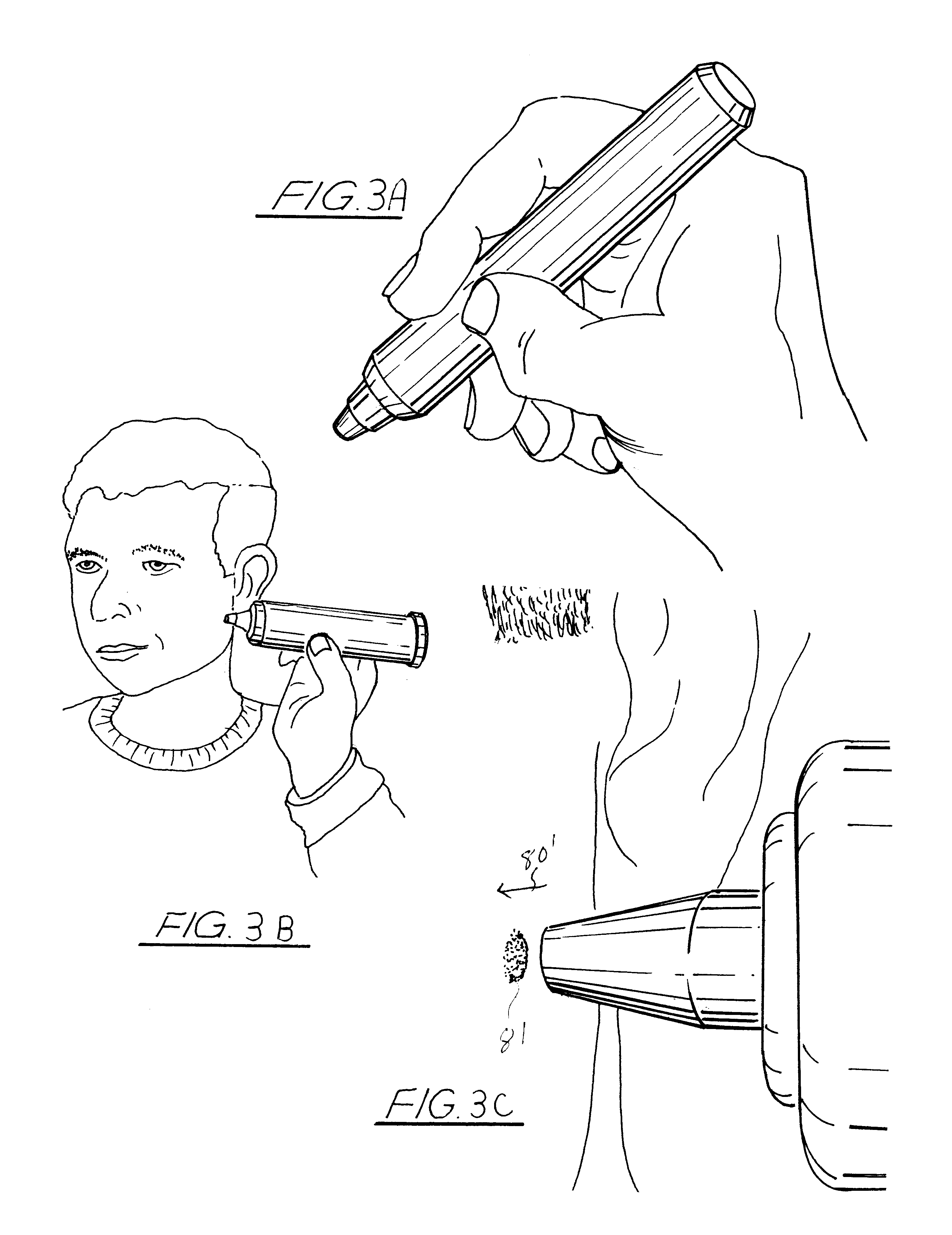 Hand-held, heat sink cryoprobe, system for heat extraction thereof, and method therefore