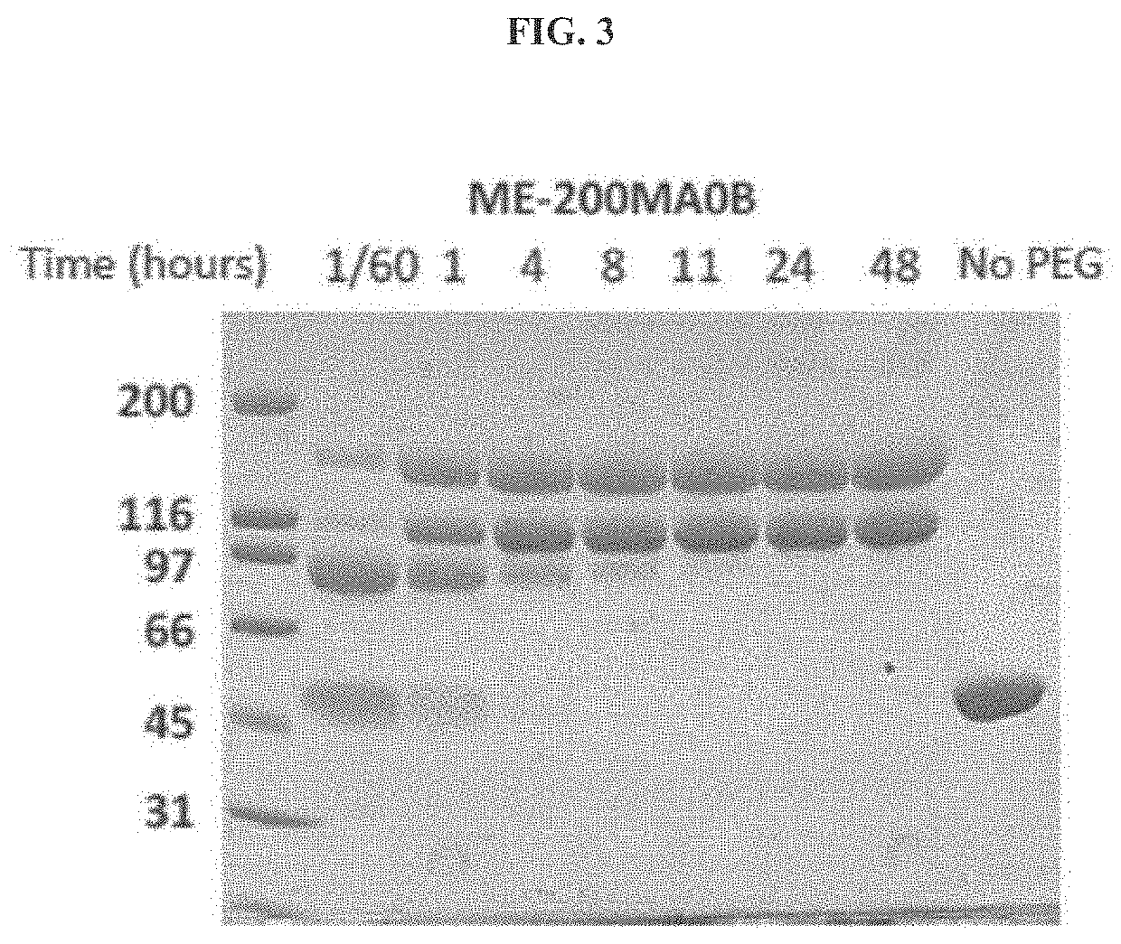 Compositions and methods for treatment of homocystinuria