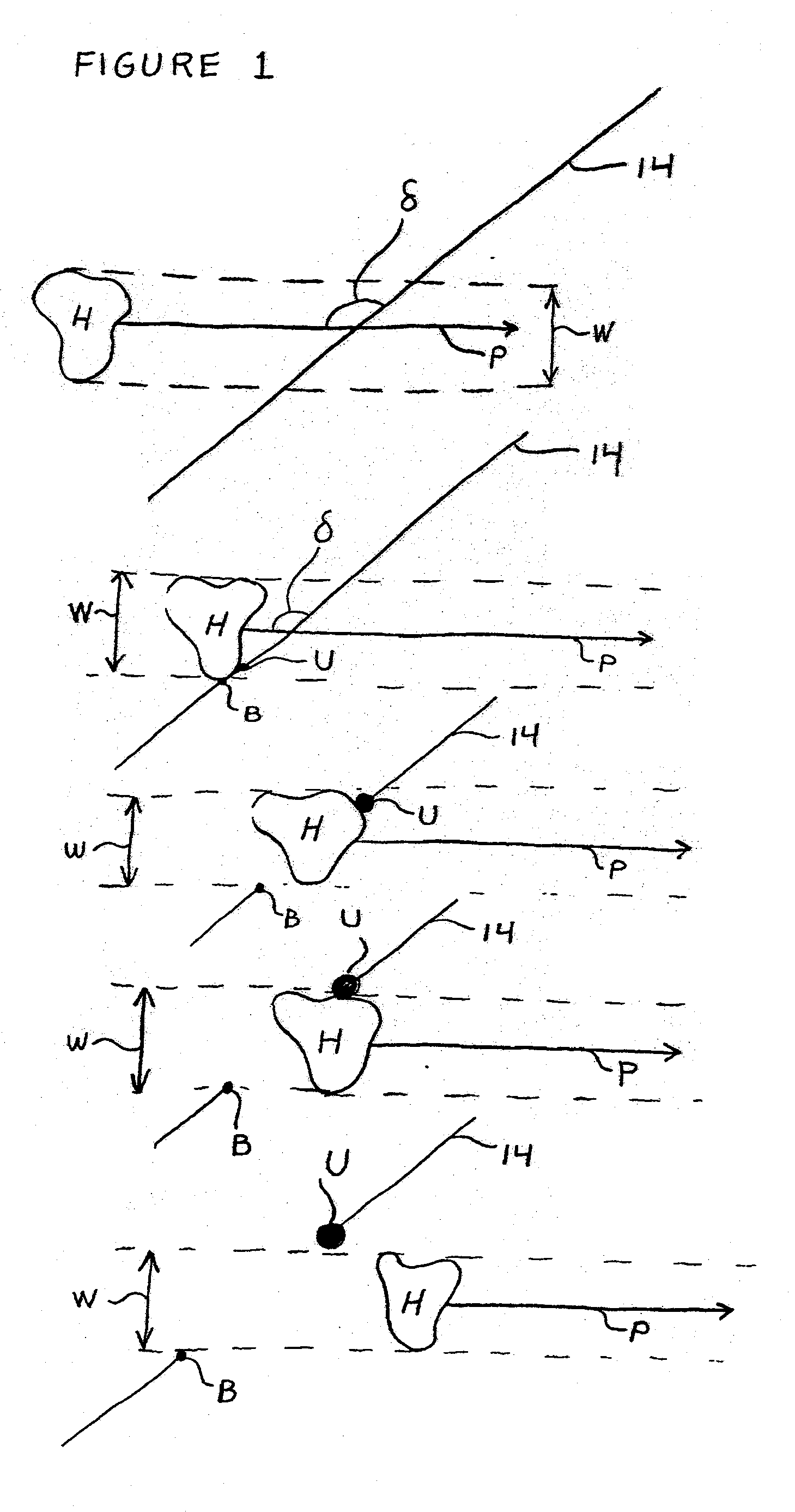 Method and Apparatus for Making a Braided Stent with Spherically Ended Wires