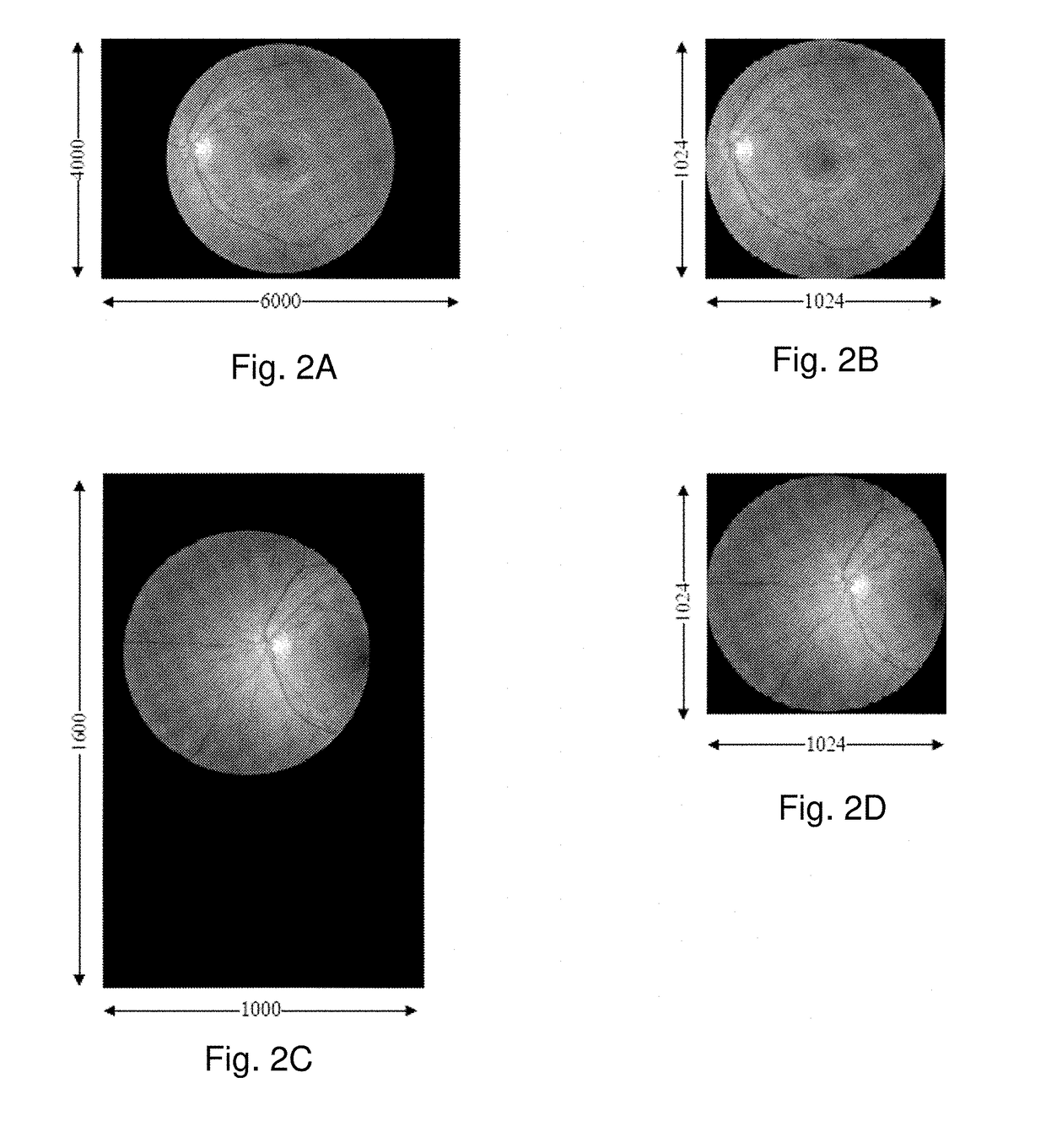 System and method for automated funduscopic image analysis