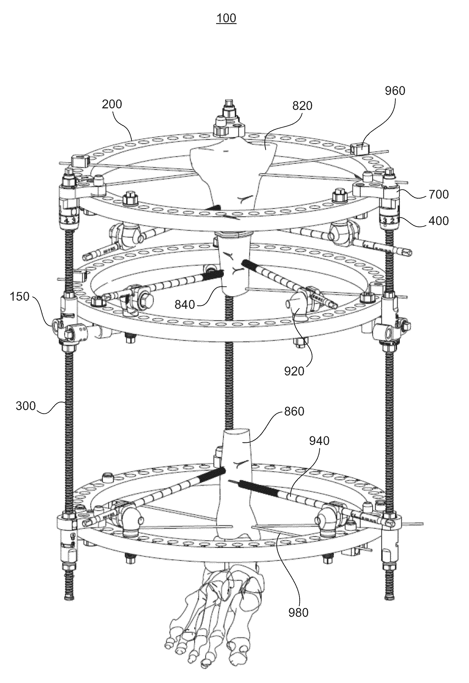 Bone transport external fixation frame