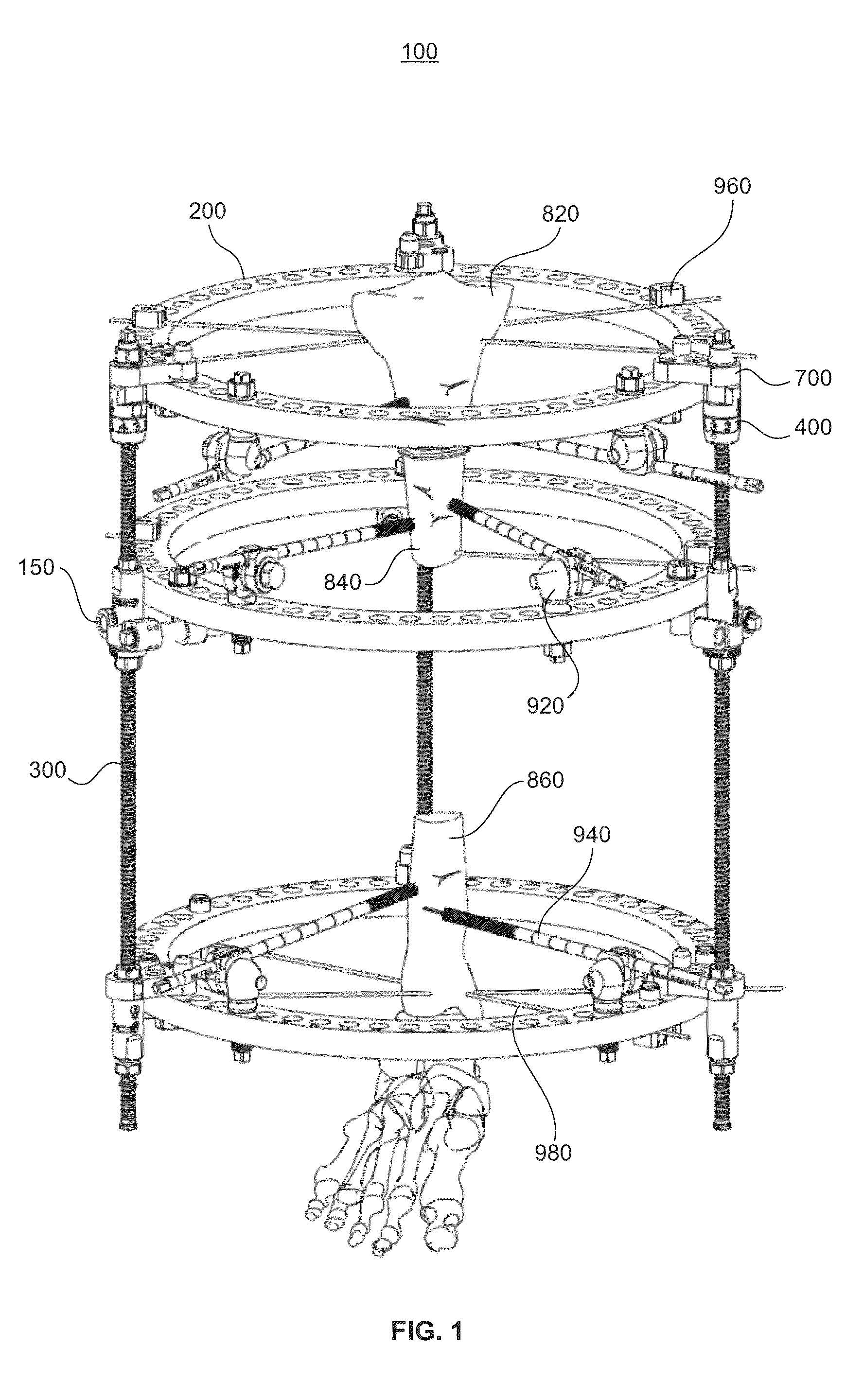 Bone transport external fixation frame