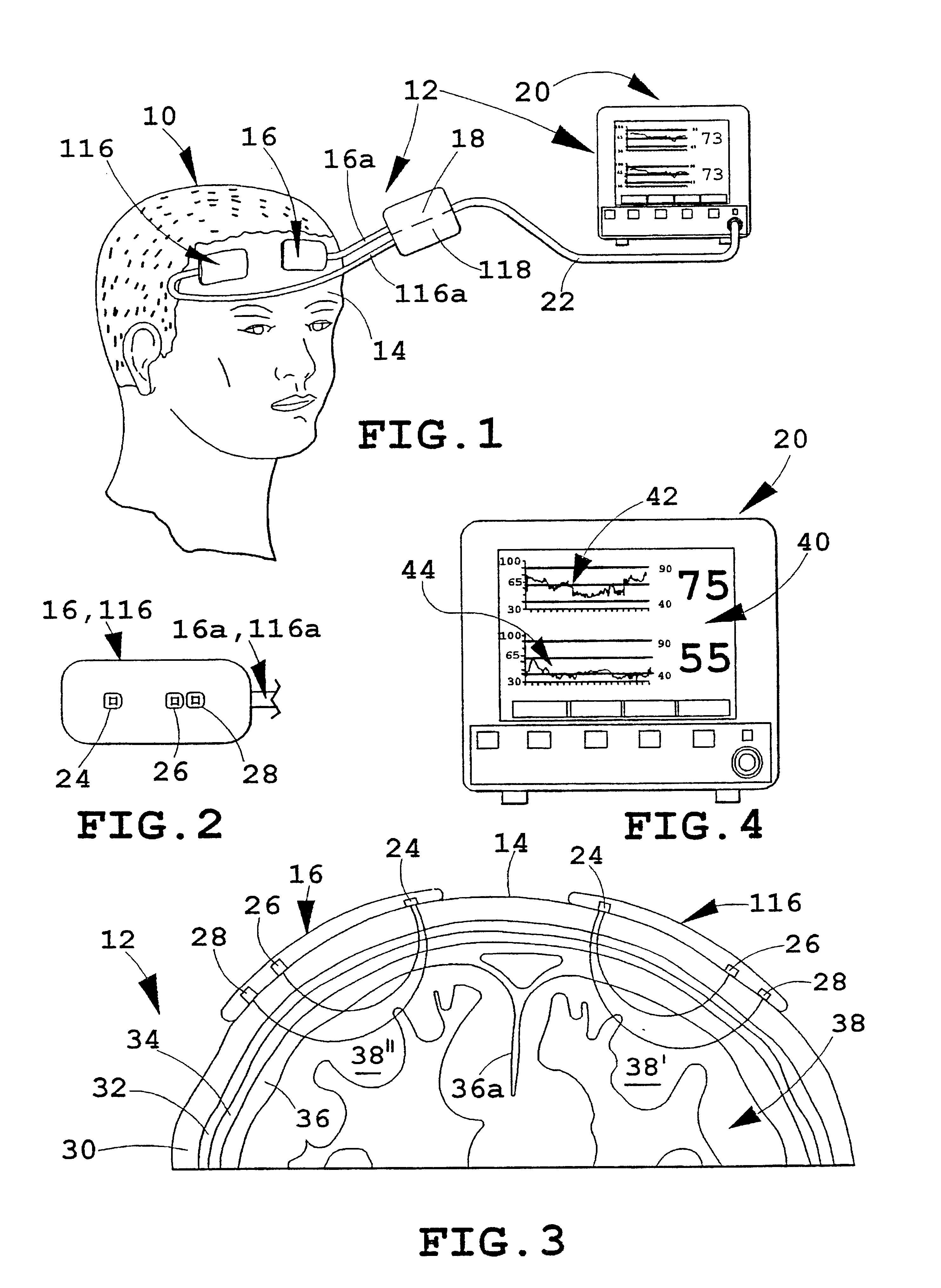 Multi-channel non-invasive tissue oximeter