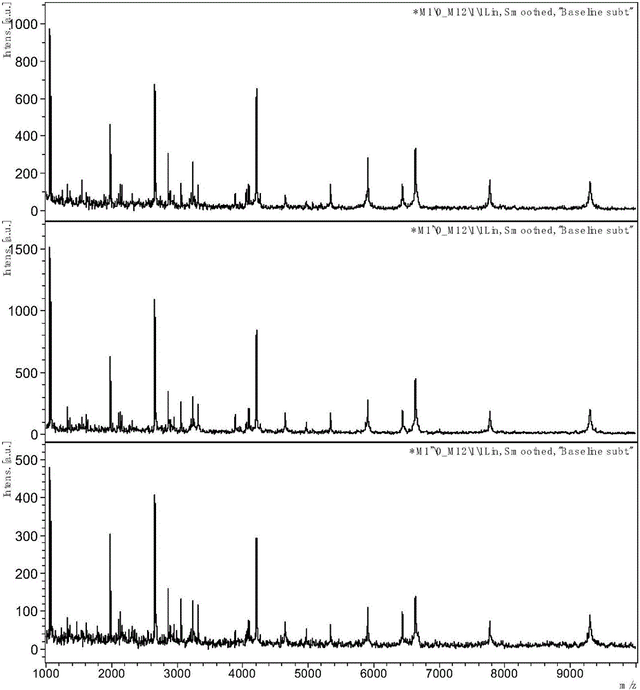 Autism serum polypeptide marker SERPINA5-A and application thereof