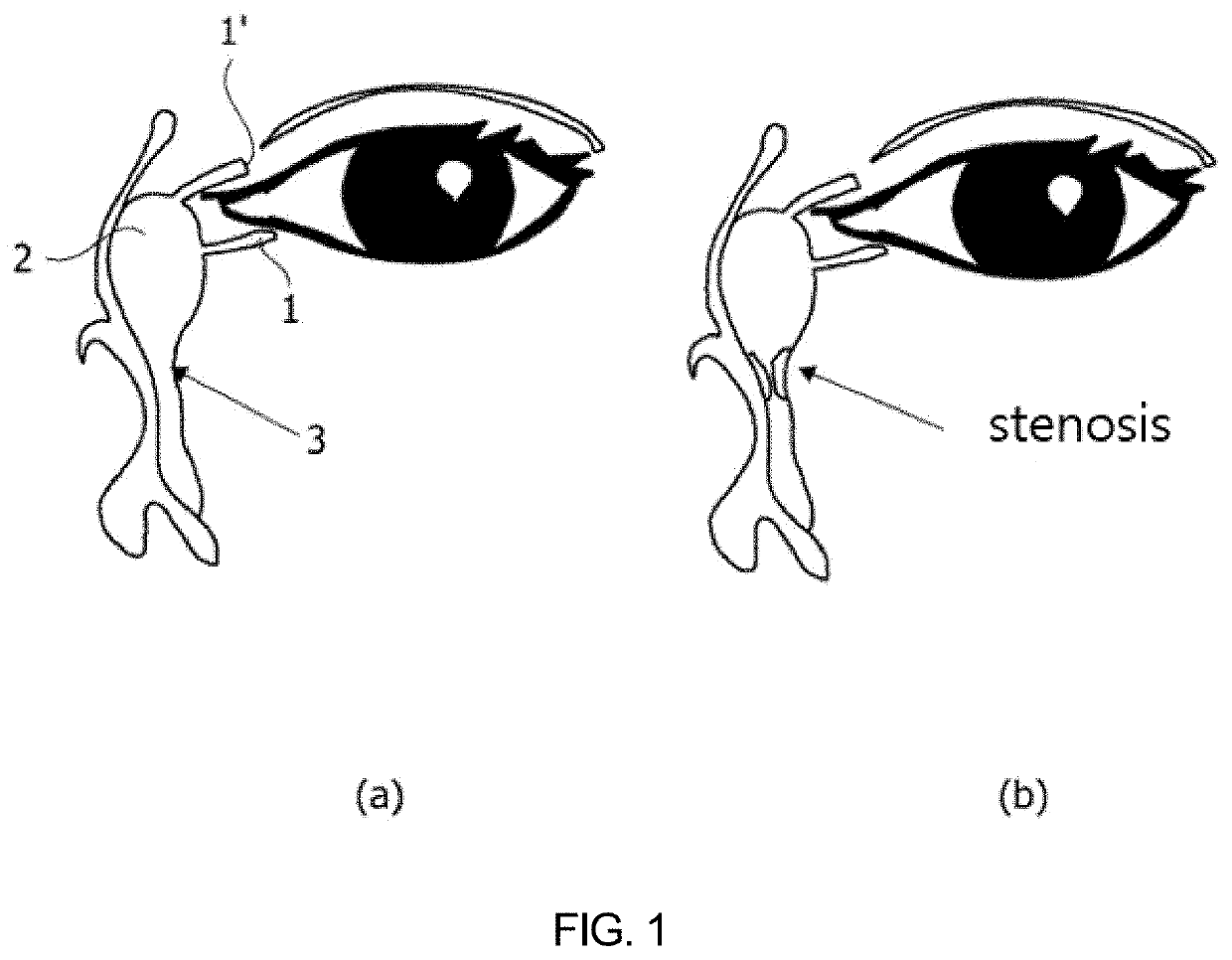 Nasolacrimal duct insertion member comprising shape memory polymer