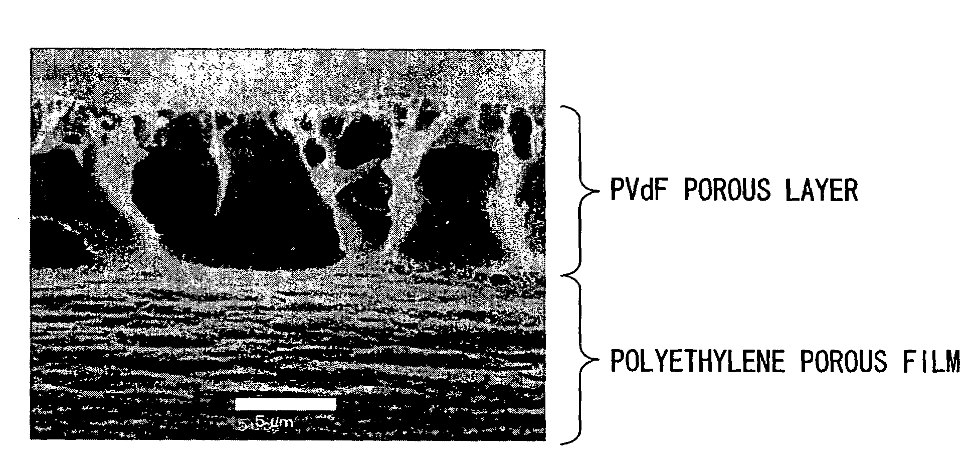 Separator for lithium ion secondary battery and lithium ion secondary battery provided therewith