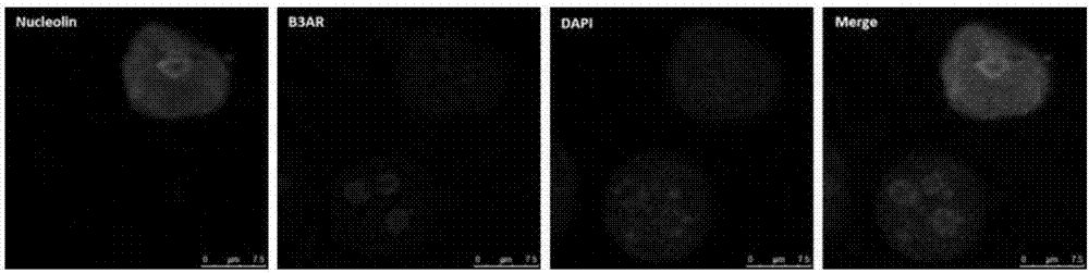 Monoclonal antibody for human ADRB3 (beta3 adrenoceptor) and application of monoclonal antibody to disease diagnosis and treatment