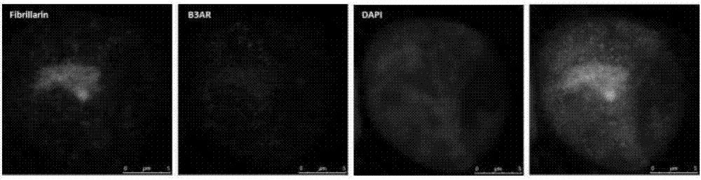 Monoclonal antibody for human ADRB3 (beta3 adrenoceptor) and application of monoclonal antibody to disease diagnosis and treatment