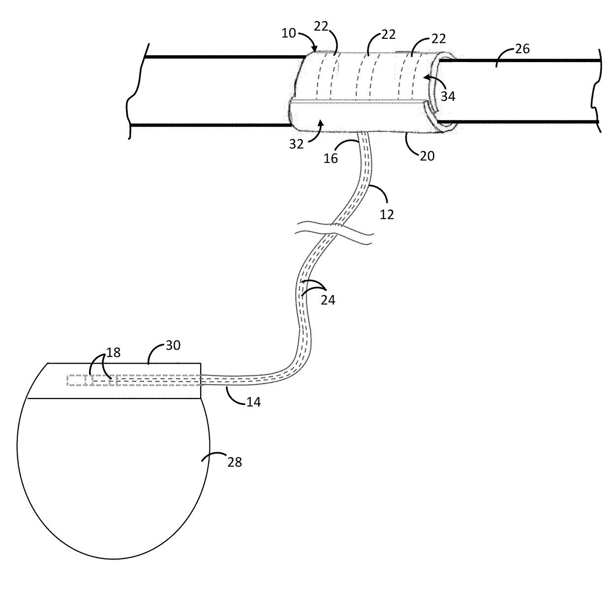 Self-expanding nerve cuff electrode