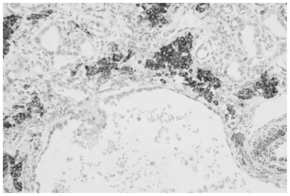 Anti-human statin alpha monoclonal antibody, preparation method thereof, immunodetection reagent and application