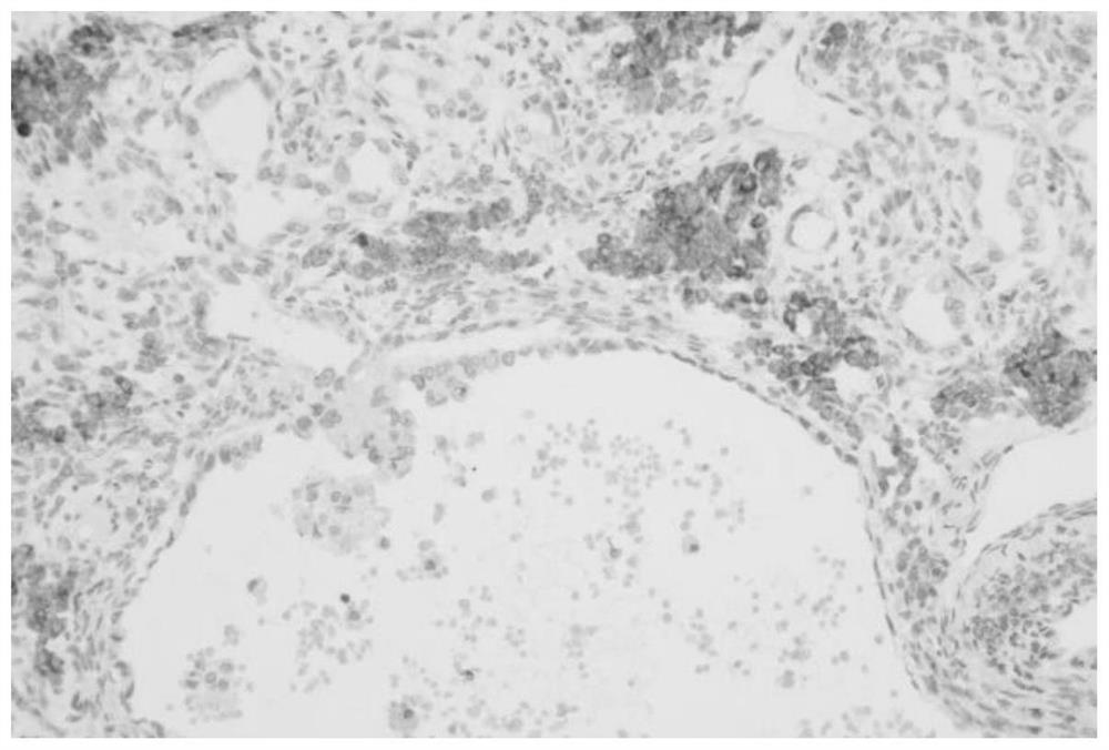 Anti-human statin alpha monoclonal antibody, preparation method thereof, immunodetection reagent and application