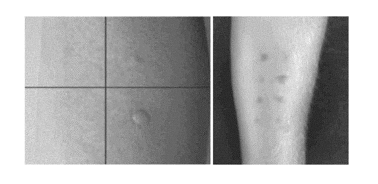 Image correction and metrology for object quantification