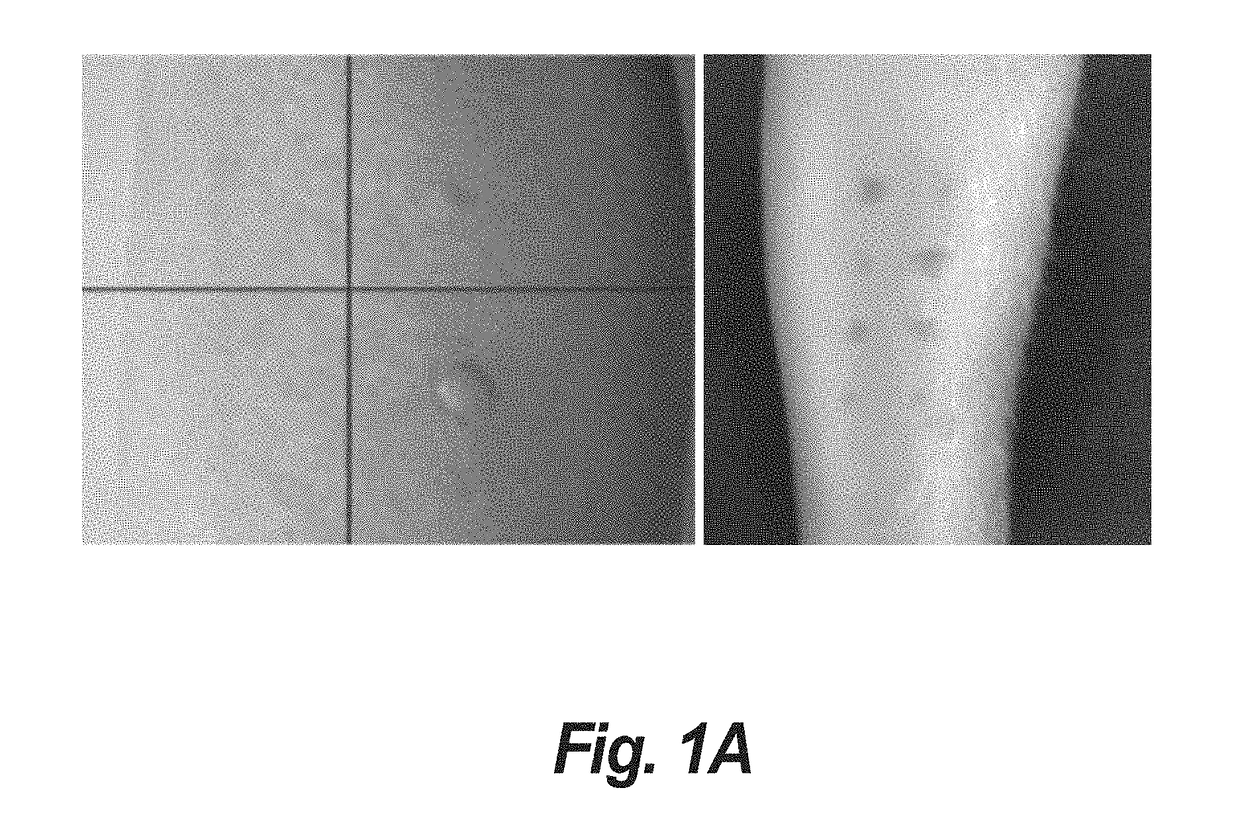 Image correction and metrology for object quantification