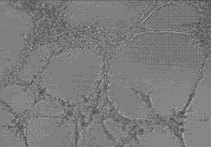 Tumor angiogenesis inhibitor jilintong, preparation method and uses thereof