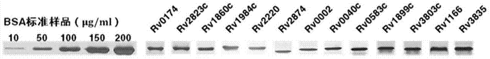 A Mycobacterium tuberculosis whole protein chip and its application