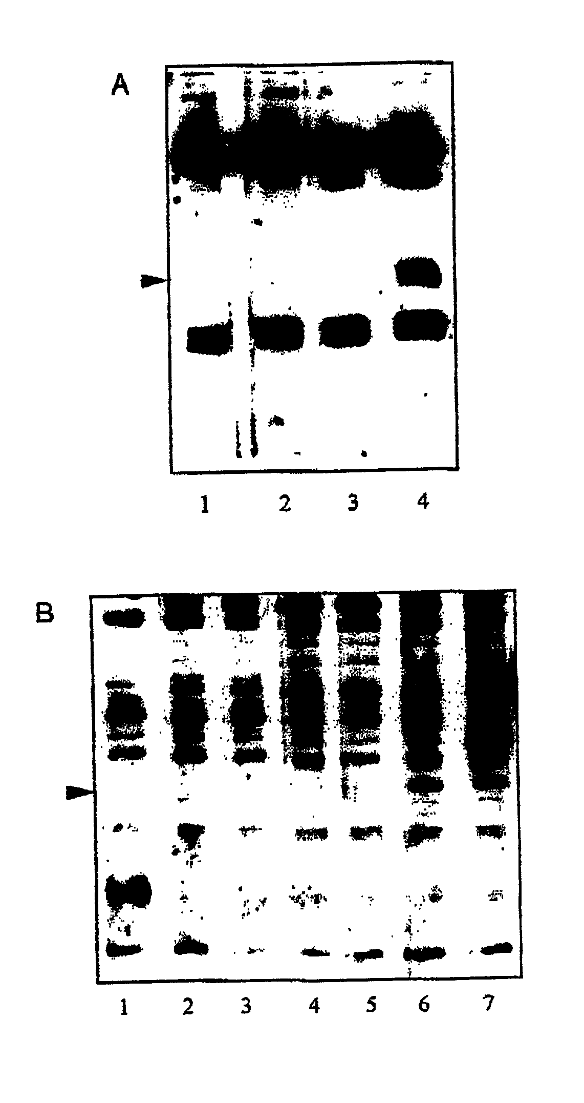 Clostridium difficile vaccine