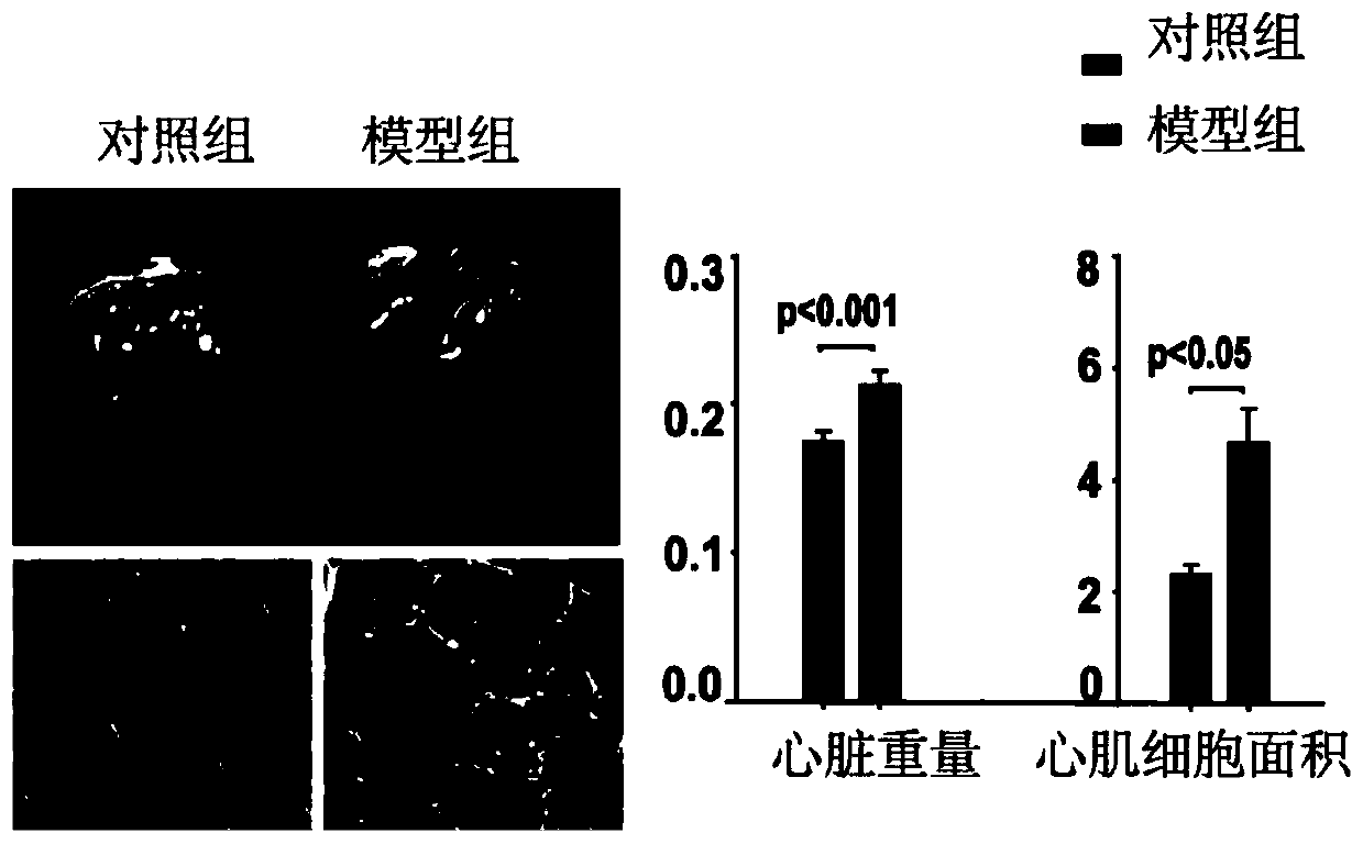 Application of a polypeptide or its derivatives in the treatment of hypertensive cardiac hypertrophy