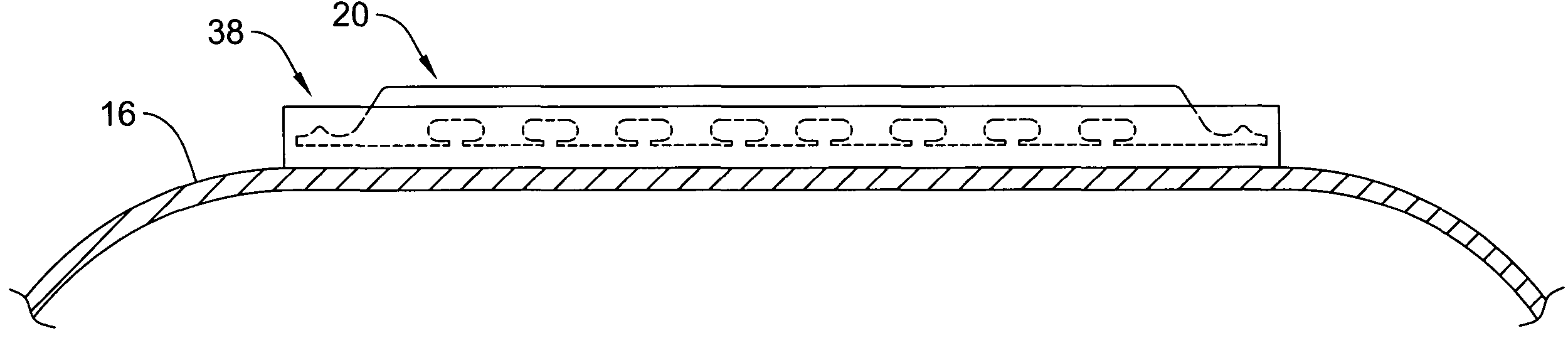 Cutting balloon catheter and method for blade mounting