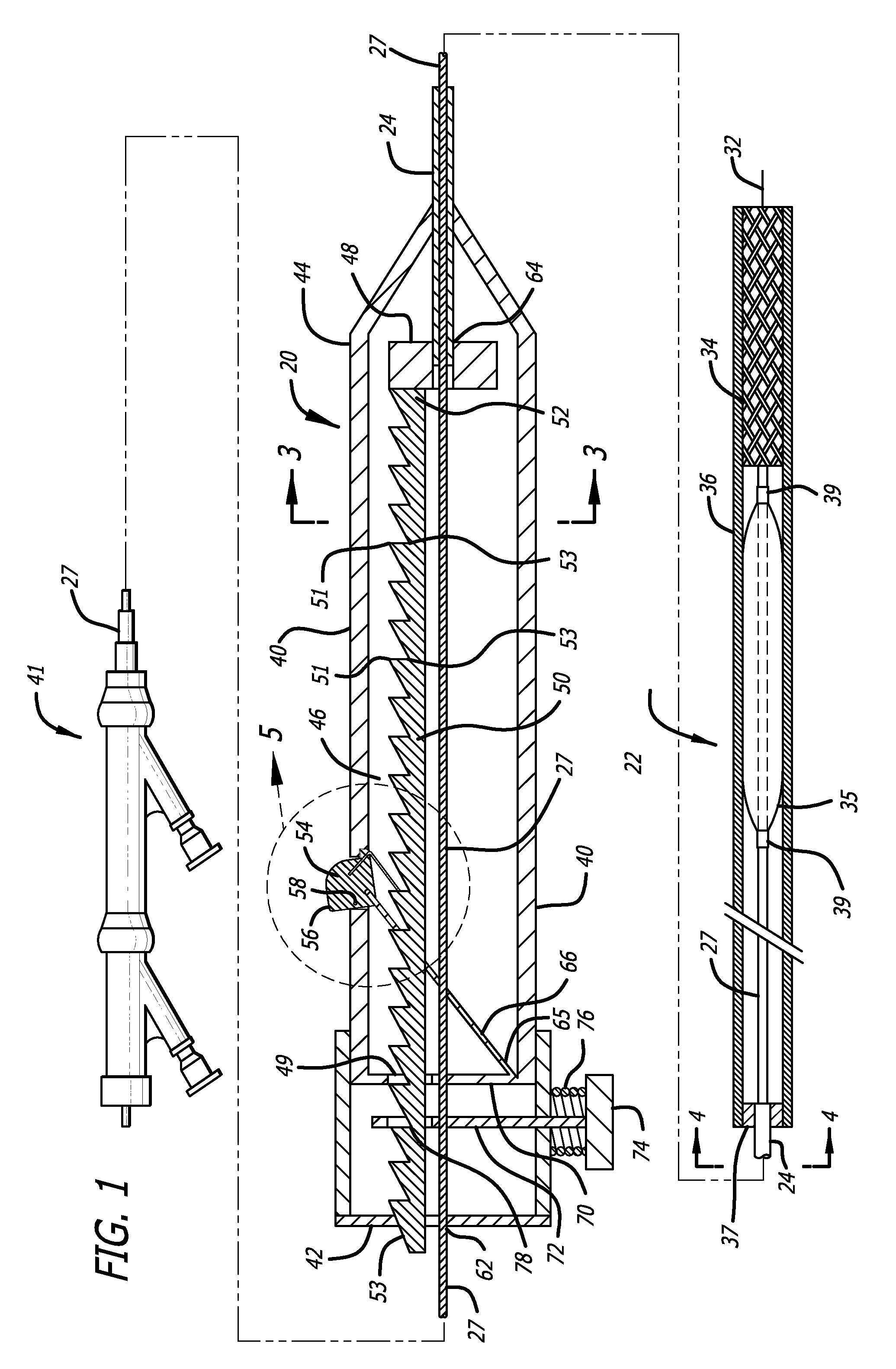 Handle for stepwise deployment