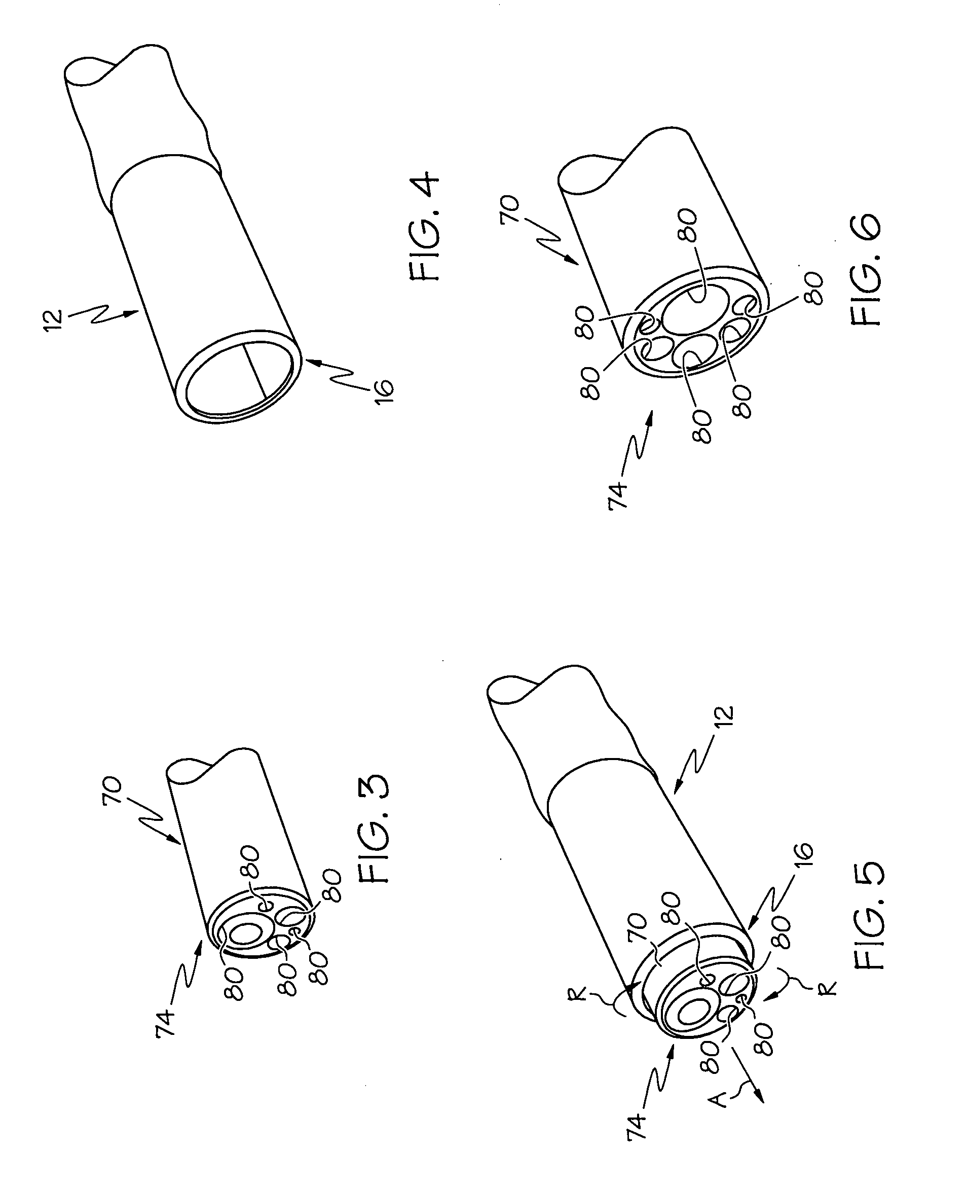 Manipulatable guide system and methods for natural orifice translumenal endoscopic surgery