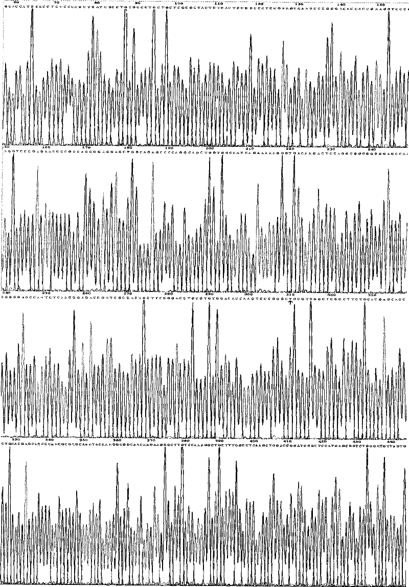 Medicament containing natriuretic peptide gene as well as preparation method and application thereof