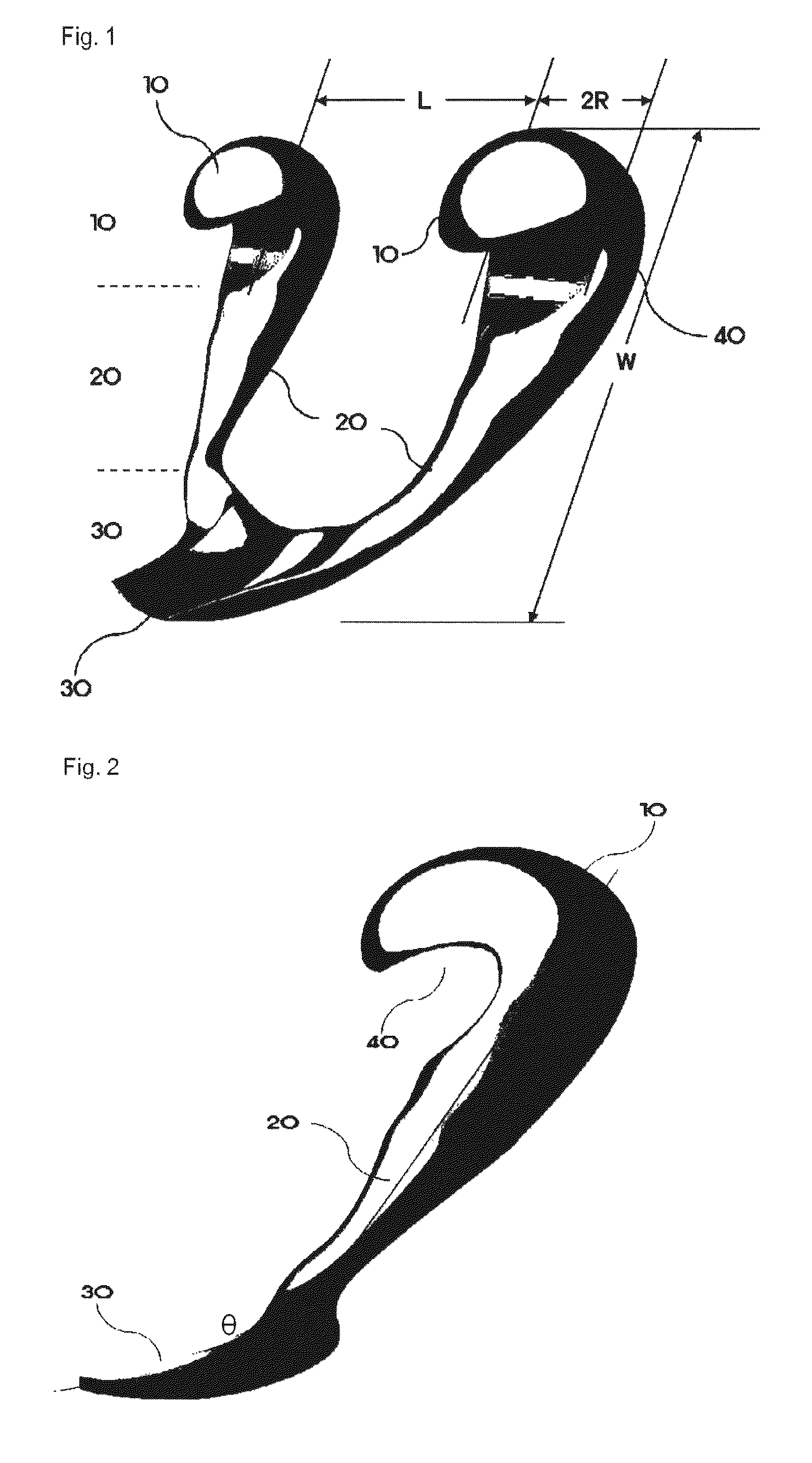 Infra-obturator tension transfer device