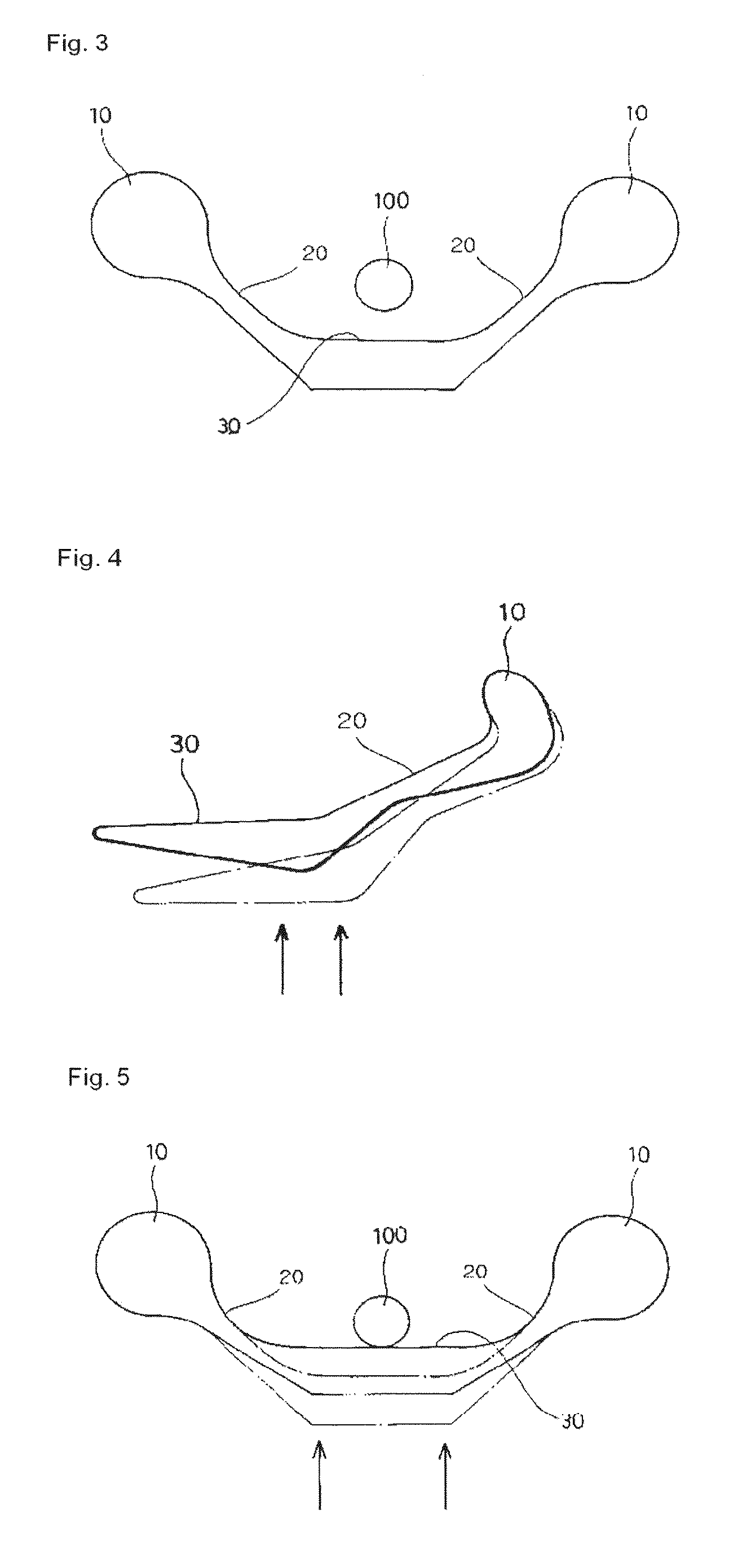 Infra-obturator tension transfer device