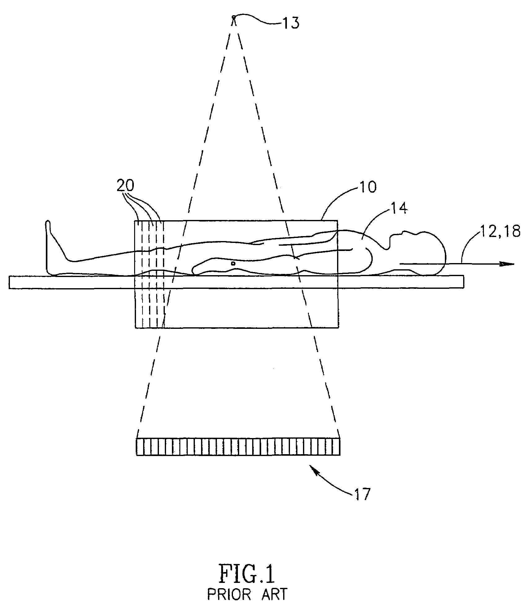 Cone beam CT scanners with reduced scan length