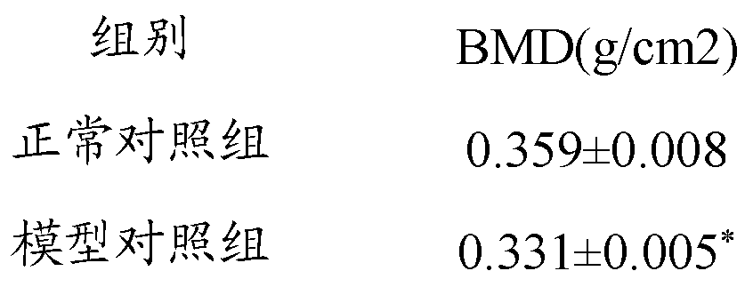 Traditional Chinese medicine composition for treating osteoporosis and preparing method of traditional Chinese medicine composition