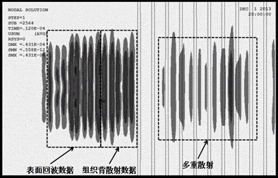 Tissue Microstructure Detection Method Based on Empirical Mode Decomposition in Quantitative Ultrasound System