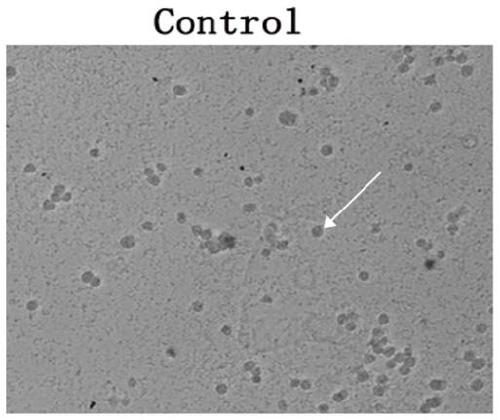 Cardiovascular implant for regulating and controlling immune response and promoting intimal regeneration and preparation method of cardiovascular implant