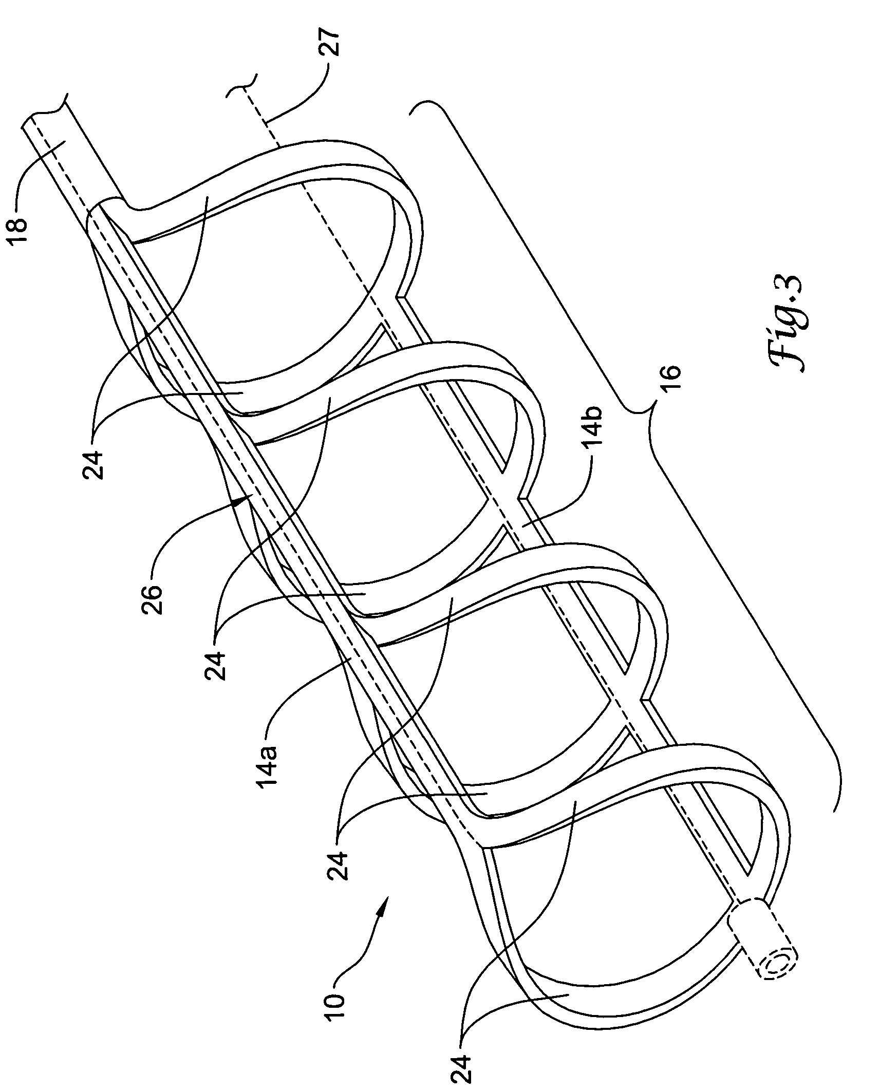 Laser-cut clot puller