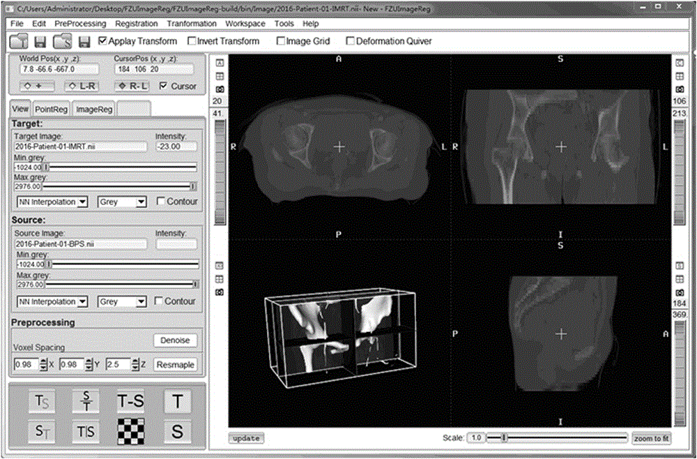 Multimodal medical image registration and visualization method