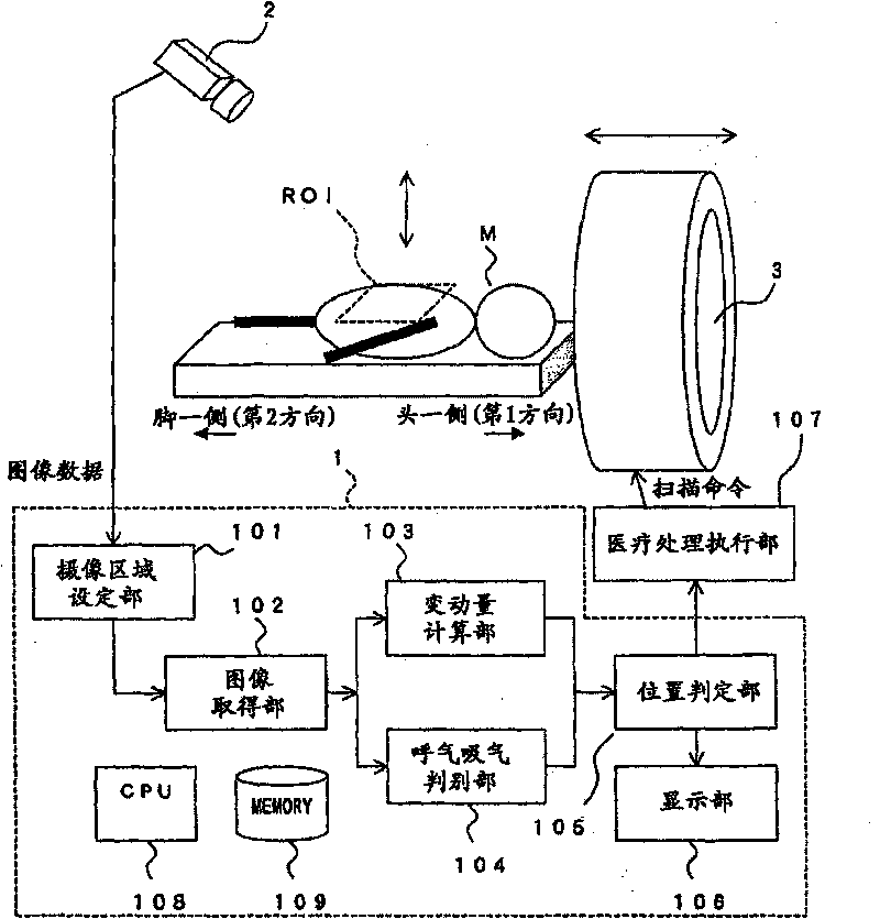 Respiration monitoring device, respiration monitoring system, medical treatment system, respiration monitoring method, and respiration monitoring program