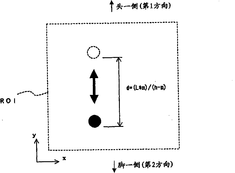 Respiration monitoring device, respiration monitoring system, medical treatment system, respiration monitoring method, and respiration monitoring program